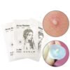 2_org_zoom-93.jpg Acne Pimple Master 24 Patch - Sivilce Bandı