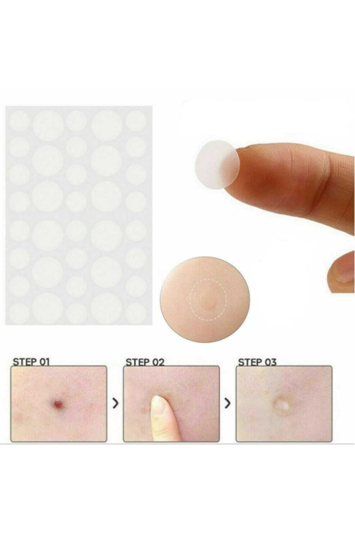 Acne Pimple Master 24 Patch - Sivilce Bandı - Görsel 4